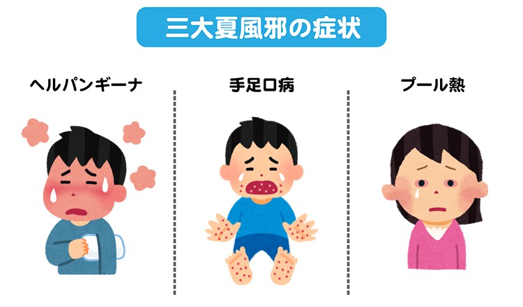 大人のヘルパンギーナに注意しましょう