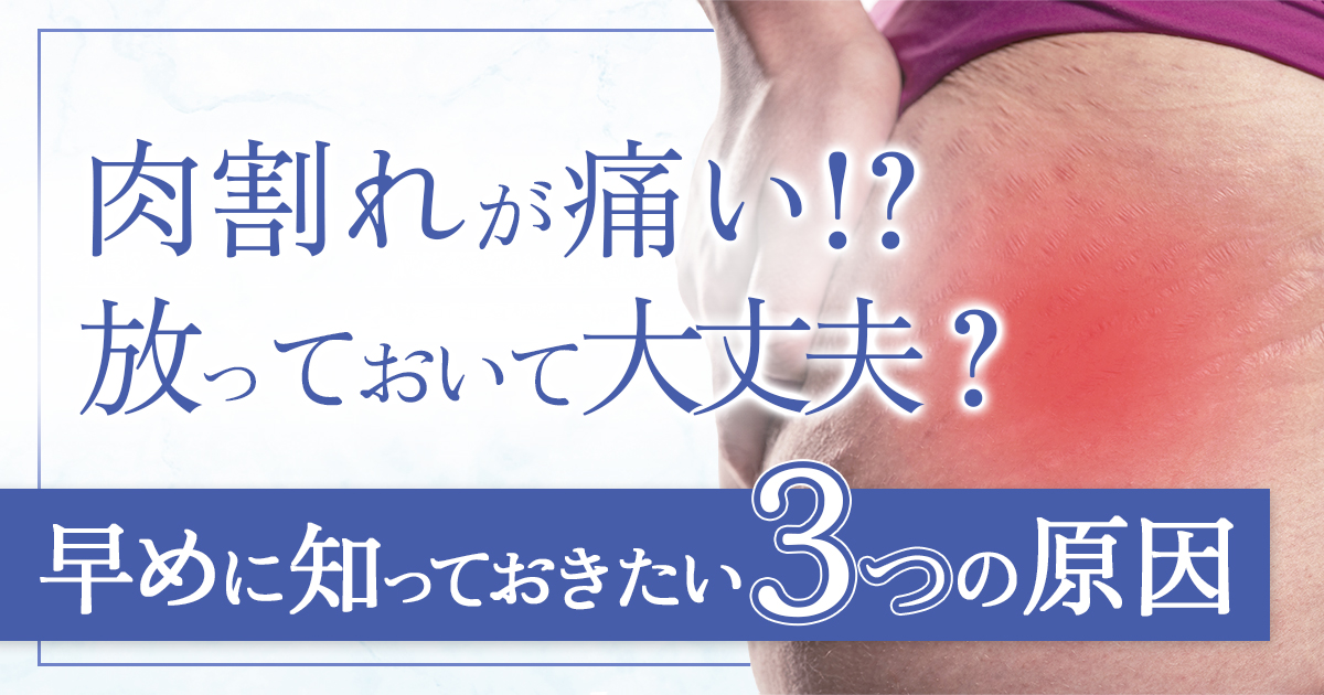 美容皮膚科「妊娠線・肉割れ」の症例写真聖心美容クリニック大阪院