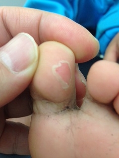 新生児の皮がむける「新生児落屑」って？赤ちゃんの体の特徴について 助産師監修公式 SOLIA SHOP