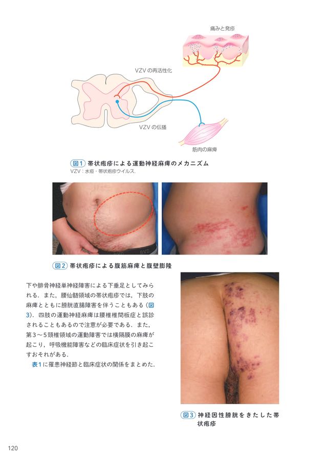 帯状疱疹＆ヘルペス船橋ゆーかりクリニック船橋駅北口