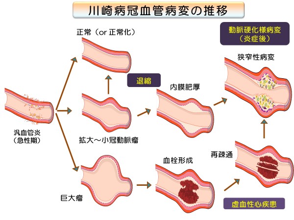 医師監修・作成 子供 小児 の心不全の治療はどういったアプローチをするべきかMEDLEY メドレー
