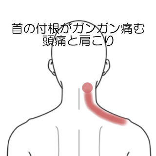 肩甲骨はがしグッズ 首 肩こり 肩周り 背中 マッサージ ツボ押しの通販 by メープル's shopラクマ