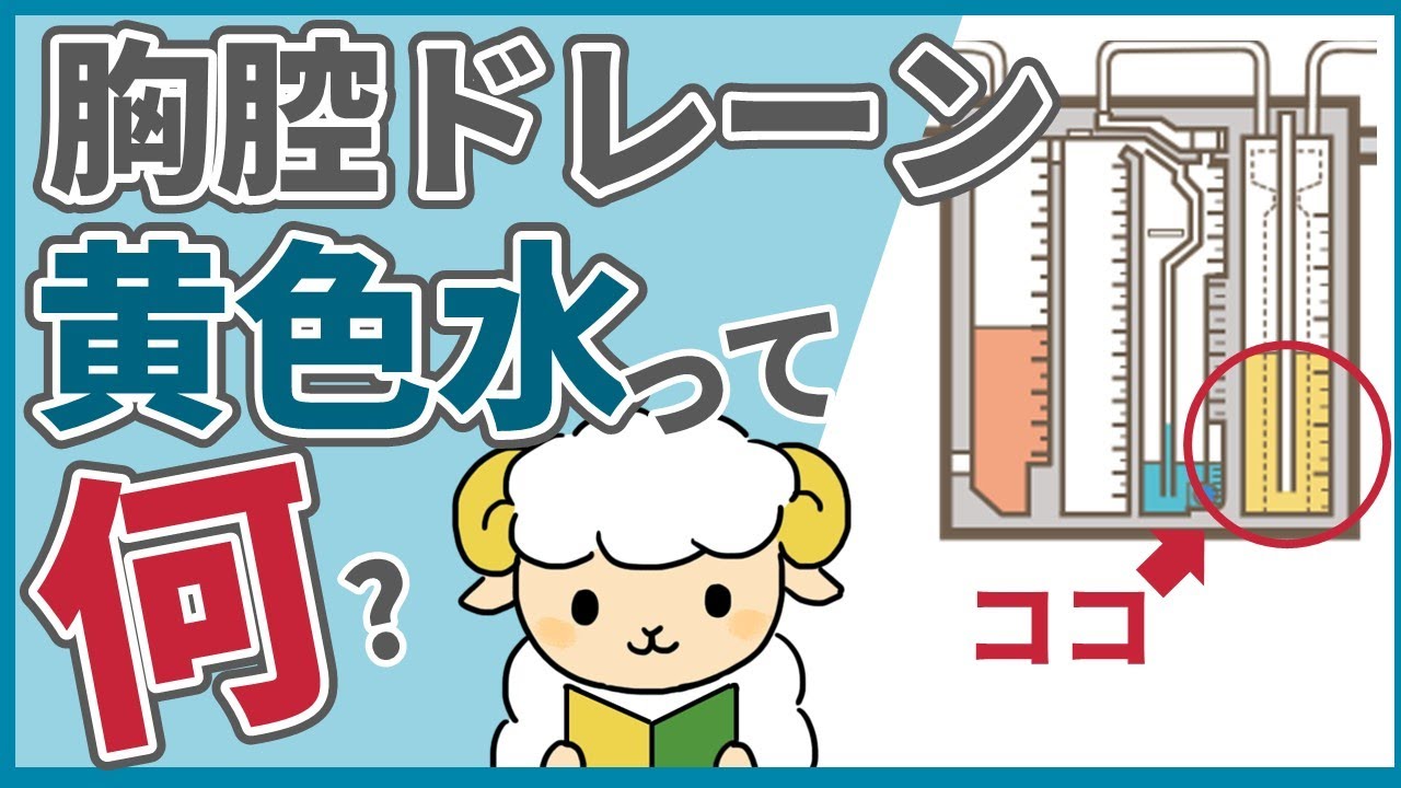 2025年最新 胸腔ドレーンの看護仕組み・管理やエアリーク・抜去・観察項目ナースのヒント
