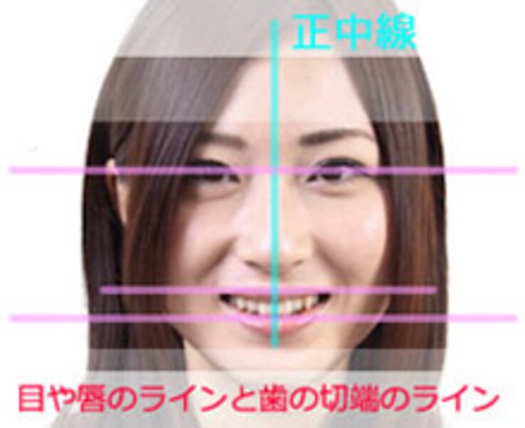 インレーとクラウンの違いとは？特徴やメリット、適応症を比較しながら解説！ - 宝塚ライフ歯科クリニック