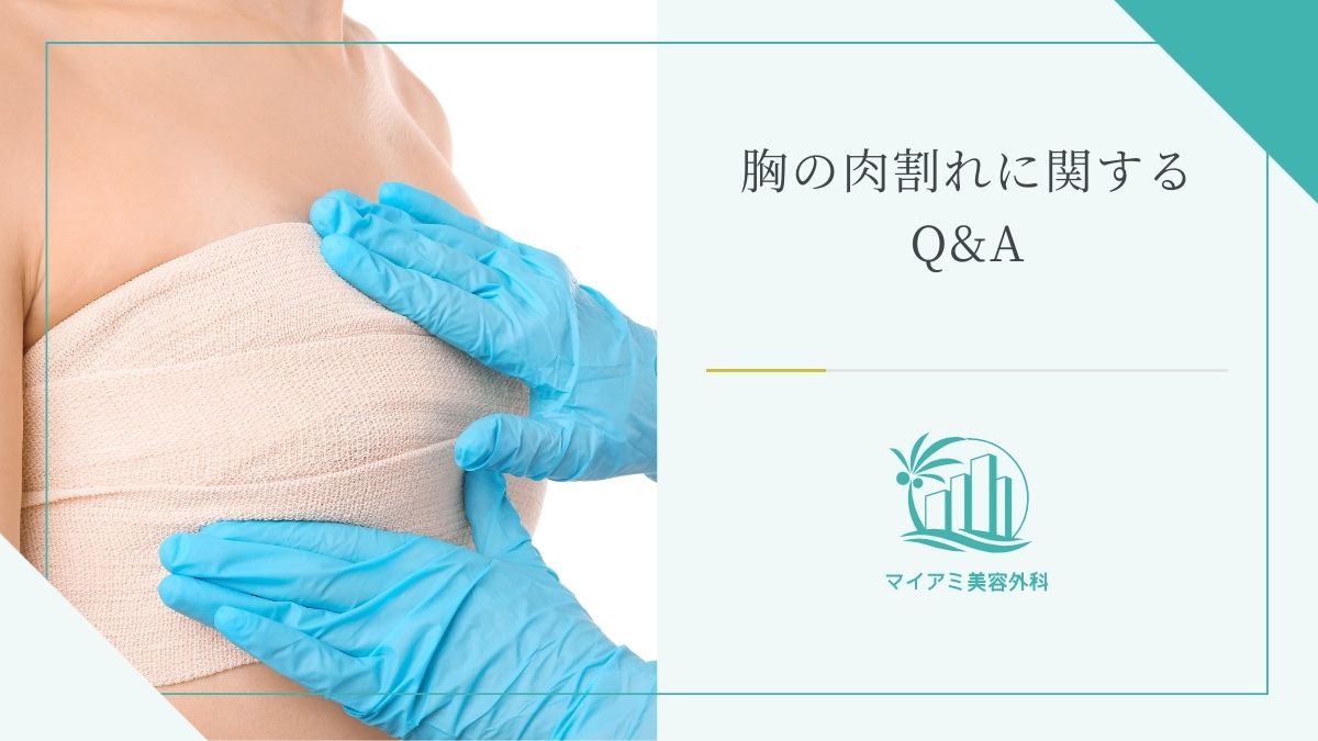 ストレッチマークの原因と薄くする方法WINBACK ウィンバック ポータル