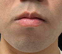 口周り ヒゲ 濃い 女 知恵袋TikTok