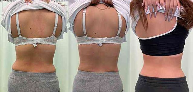 コルセットダイエットの効果とやり方！2ヶ月で痩せるまでの道のりをお届け 美容ライターのビューティ最前線！ 美容メディアVOCE ヴォーチェ