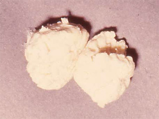 黄疸、気にし過ぎてる？都内に住むキャンプ好きの4人家族☆