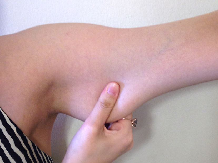 二の腕 太い」の1658点のロイヤリティフリー画像、写真素材、絵Shutterstock