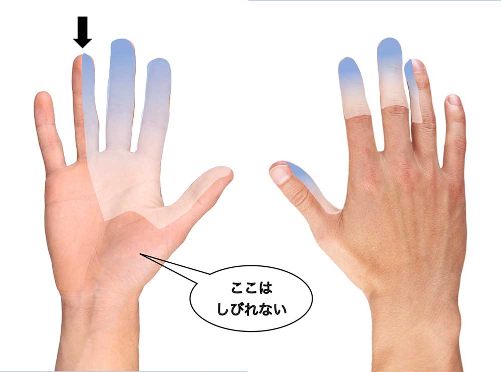 しびれ外来成城脳神経クリニック