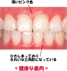 歯医者さんに「初期むし歯」と言われたら！「初期むし歯」を毎日のケアで健康な歯にLidea リディアby LION