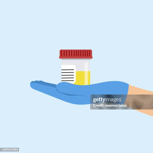 尿検査のイラスト🎨 フリー素材 看護roo! カンゴルー