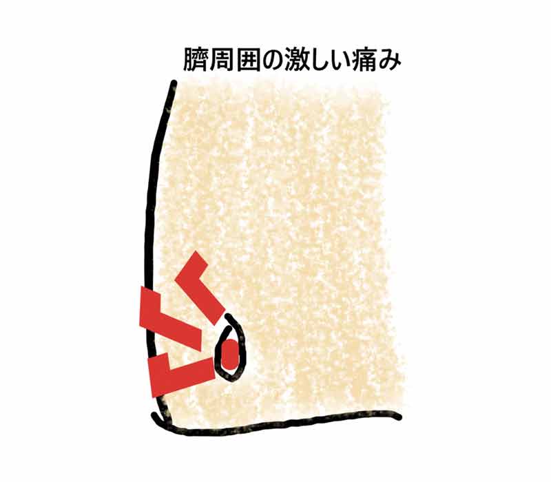 ⑧臍炎，臍周囲炎，尿膜管遺残症，卵黄囊管遺残症JIM 15巻6号医書.jp