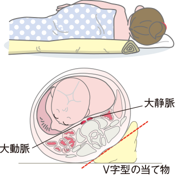 産前 妊娠中ってどんな寝方がいいの？洛西口・桂川の京都中丸整体カイロプラクティック院長ブログ京都市西京区 洛西口・桂川 の整体なら京都中丸整体カイロプラクティック