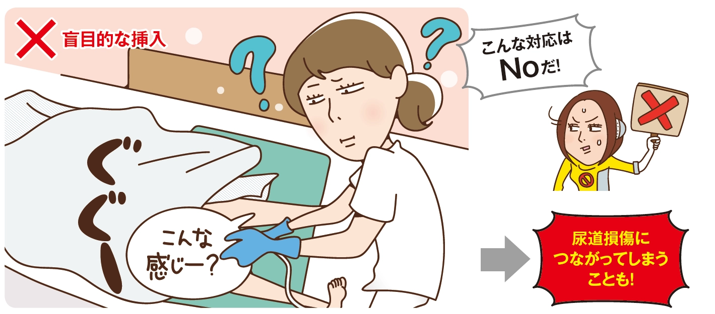 がん情報サイトがん情報各論： 患者さん向け 尿道がんの治療 PDQ®