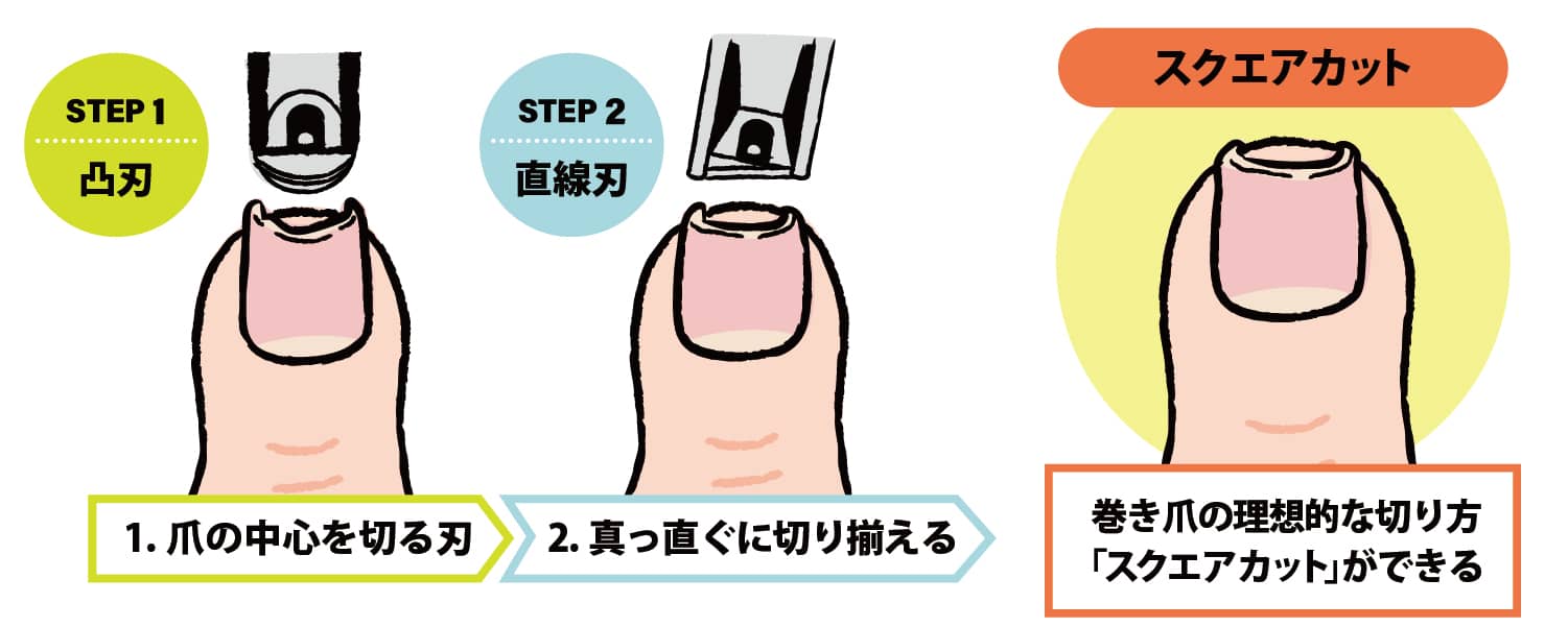 セルフケア 巻き爪編巻き爪巻き爪専門 自由が丘ひばり整爪院 東京都世田谷区