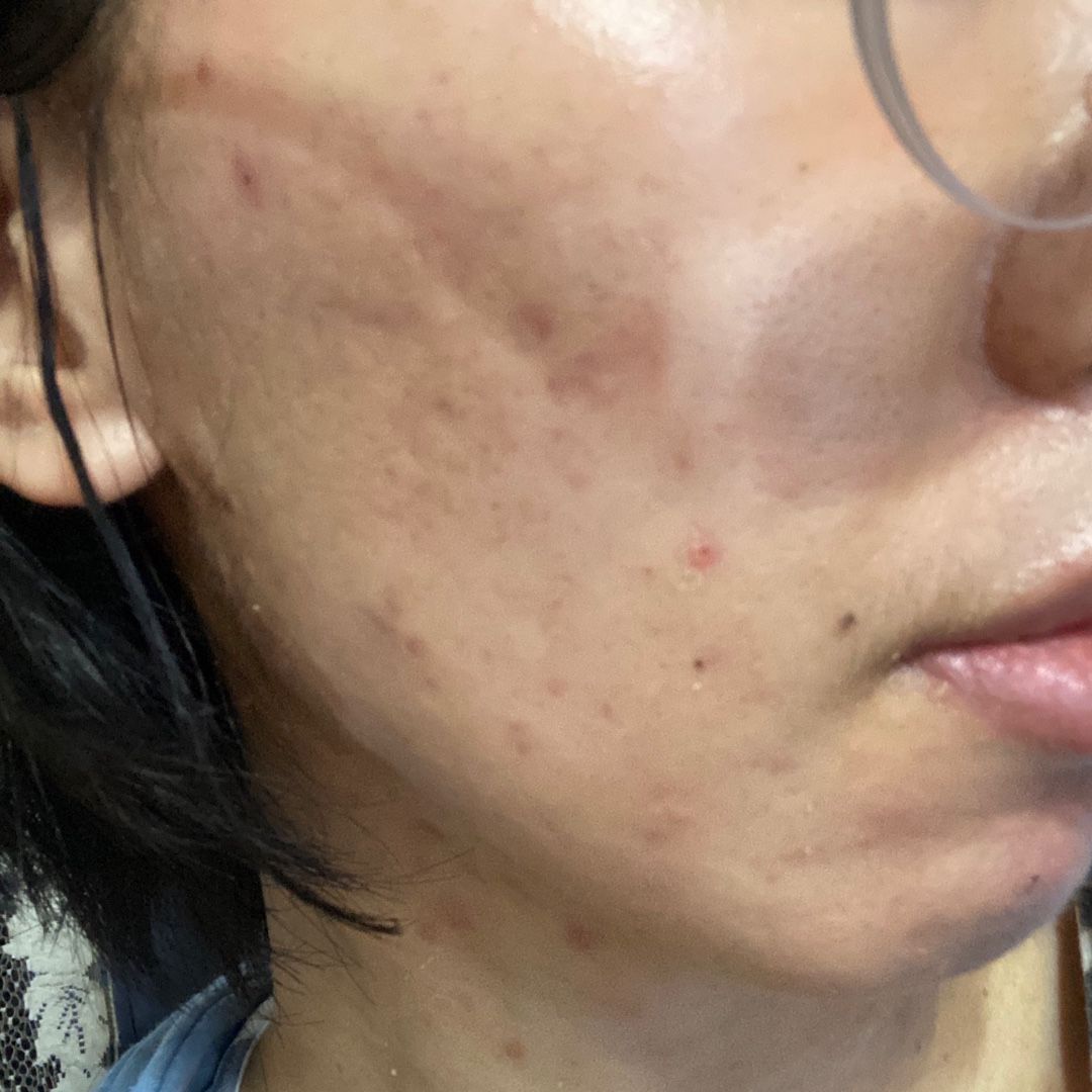 肌断食 ブログ 腸活 肌断食やめたブログ東京都の整理収納サポート、腸内解析アドバイス - Leaf&Soil