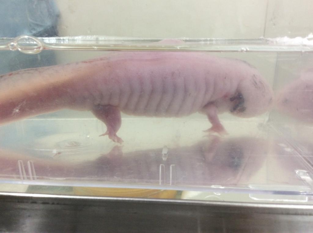 がんで腹水が溜まると余命はどれくらい？原因や腹水を減らすツボを解説 - だ液でがんリスク検査 サリバチェッカー株式会社サリバテック