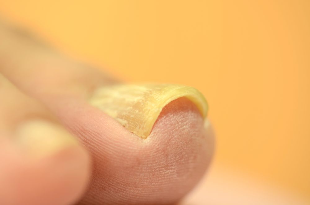 足の爪のトラブル吉祥寺駅徒歩2分の皮膚科 かまだたきこ皮フ科クリニック