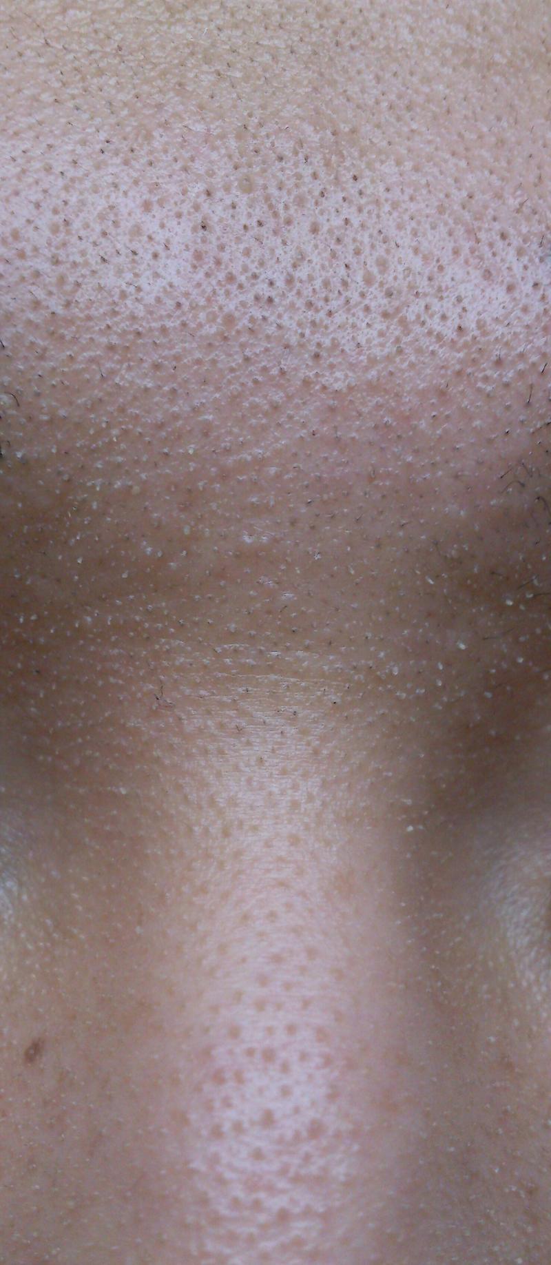 ご質問にお答えします☆角質培養と毛穴とパートナーと私鼻の毛穴の黒ずみつまりに本当に効く対策とは