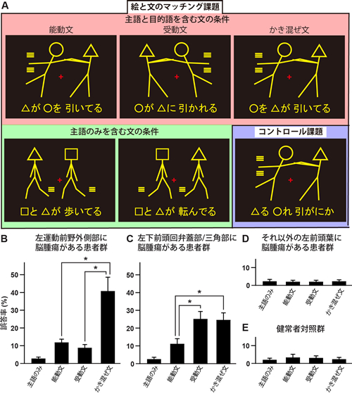 中核症状ー失認ー脳疾患を知る桑名眼科脳神経クリニック