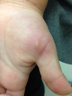 治療内容案内 皮ふ科- 皮ふ科・内科 中川クリニック