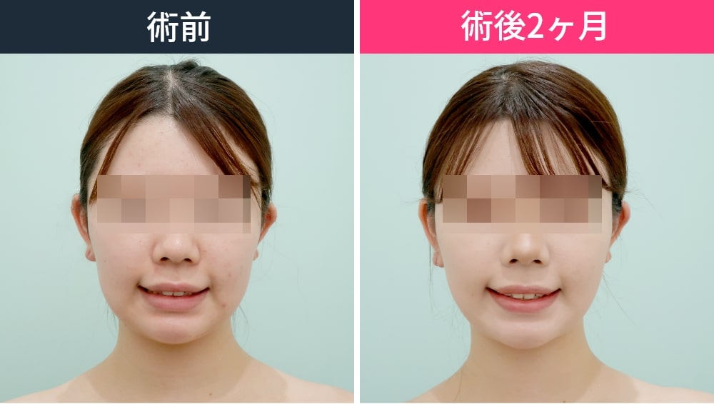 プロが教える 美人の法則！黄金比率メイク〜ポイントメイク〜 - Beauty Column 美容コラムMEIKO