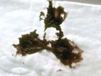 便の色・形状で健康状態が分かる？チェックするポイントとは阪神御影駅前のきのしたクリニック