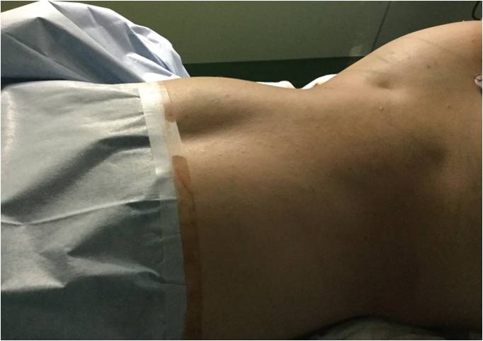 お尻にヴィーナスのえくぼの作り方骨盤周り3筋肉を鍛えるべしQITANO ® 北野カラダづくりラボ