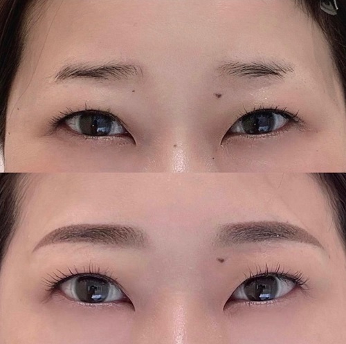 眉毛アートメイクは自眉がもともと濃い人でも受けられる！メリットや注意点を紹介眉アート・アートメイクのArt+