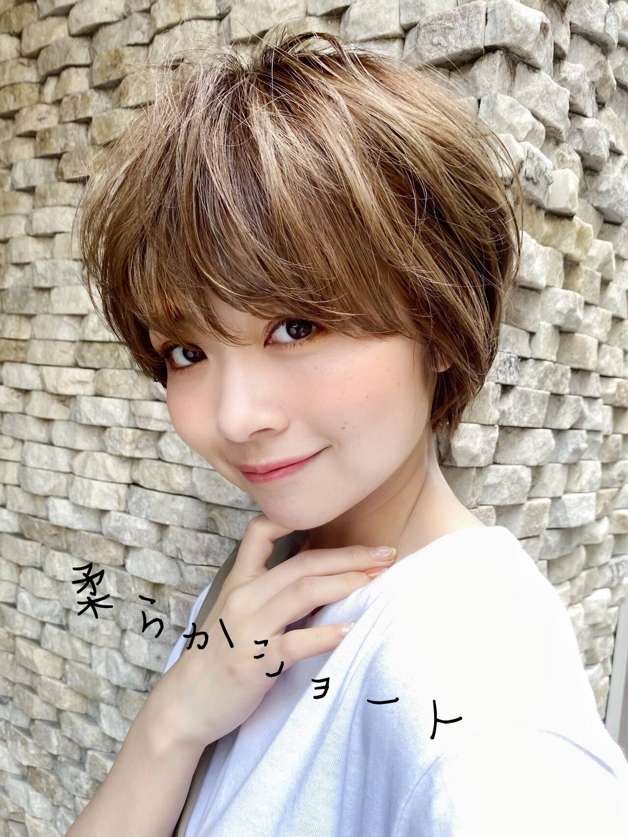 おでこのヒアルロン酸注入💉 おでこが狭い方でもしっかり変化✨ ナチュラルにおでこを丸くします☺️若返り治療をしたいけど、大きな変化はちょっと という方にもオススメなのがヒアルロン酸です。おでこの凸凹改善にももちろんのことながら、お顔の色々なところに少し