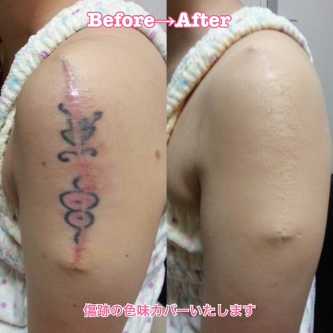 フラワータトゥー 傷跡カバーアップGIRLS ガールズNEW LISTギャラリー一覧インスクライブのタトゥー の実績を紹介しています。指定のデザインのカテゴリーが一覧で表示されます