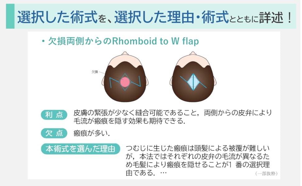 キャラ弁のレシピ本子供のお弁当作りに！人気のレシピ本の通販おすすめランキングベストオイシ