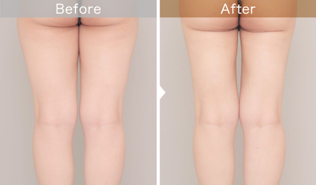 30代から気になる「たるみ」3つの原因 - 日本経済新聞