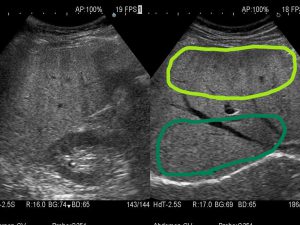 相馬医院 - 腹部エコ