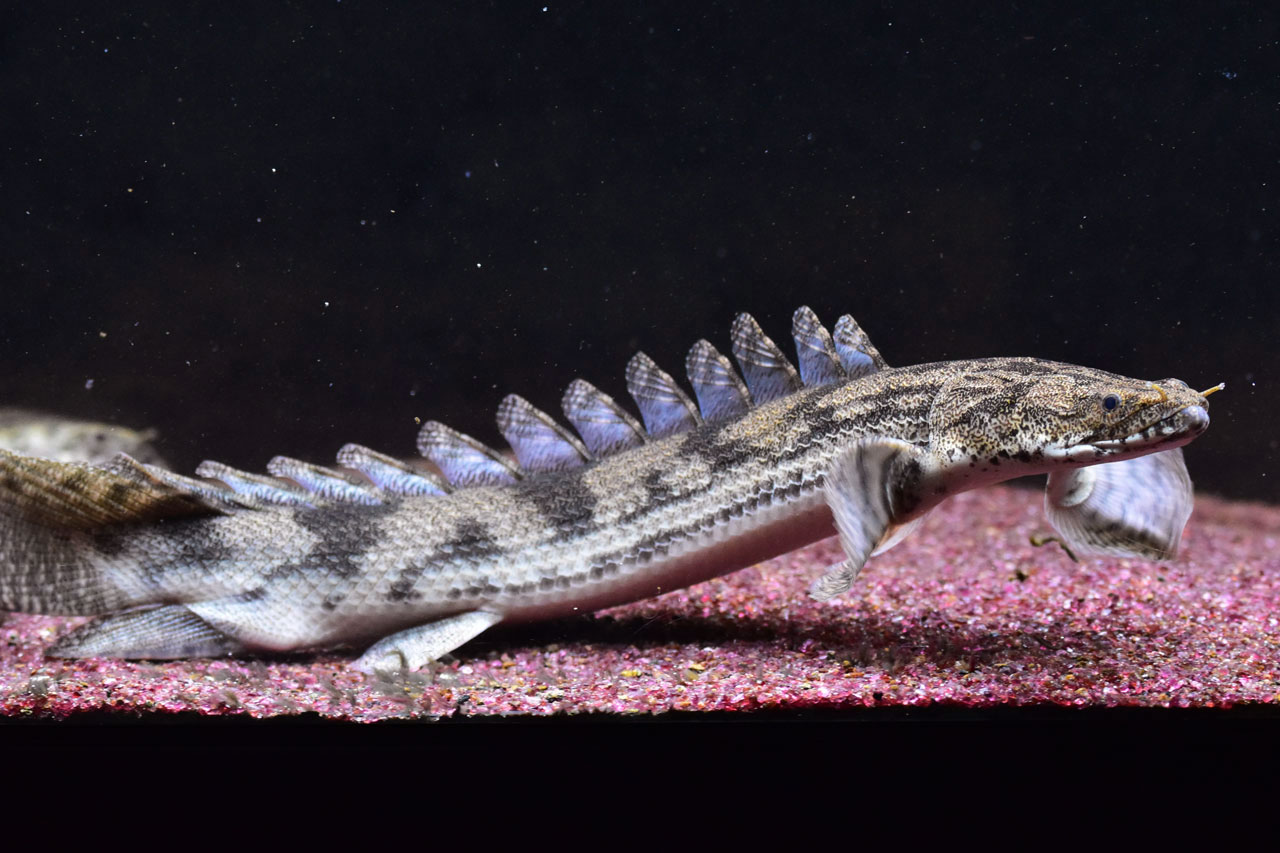 Woven EndoBridgeデバイス WEB 脳血管内治療センター診療案内福岡脳神経外科病院医療法人 光川会