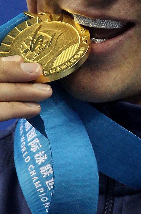 オリンピック選手はなぜ優勝した後にメダルを噛むのでしょうか