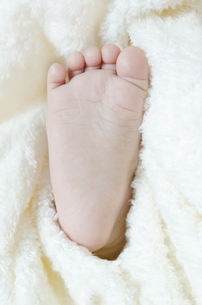 足の裏の斑点 赤ちゃんの病気・ケガ ベビーカレンダー専門家相談