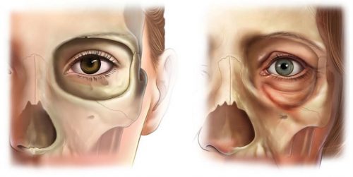 顔のたるみは頭蓋骨の骨粗鬆症が原因？！白髪が黒くなるように、老化は巻き戻せる時代に 01 近畿大学山田秀和先生