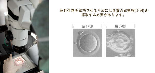 体外受精のスケジュールひと目でわかる排卵誘発方法別の流れと期間木場公園クリニック-JISART認定 体外受精・顕微授精