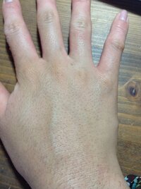 意外と見られている！手の甲や指の脱毛がおススメな理由とは千葉 ・ 柏 の メンズ 男性 脱毛 ならゼーブル柏