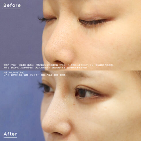 斜鼻修正術、鼻の整形なら美容外科・美容皮膚科AiZクリニック AiZクリニック アイズクリニック 美容外科・美容皮膚科