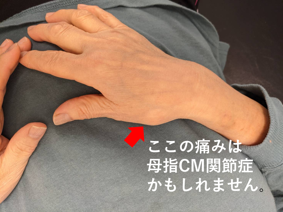 親指の付け根の痛み松戸市の上本郷レディース整形外科