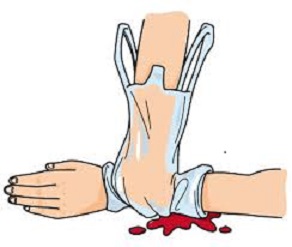 化学物質による薬傷・やけど対策について厚生労働省