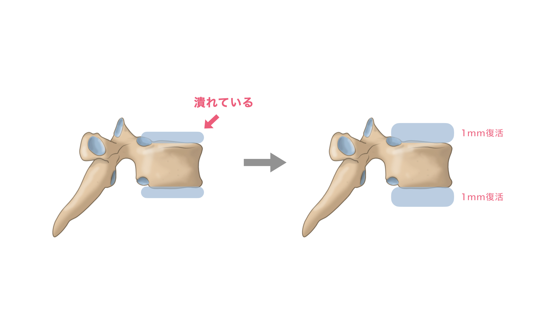 生徒さんのリアルな声 身長が伸びました福岡の大濠にあるピラティス・ヨガ スタジオKANON カノン