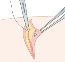 ブログ練馬区中村橋の皮膚科斉藤皮膚科美容皮膚科