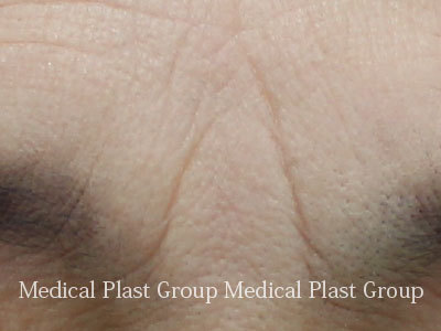 小顔メイク の仕上げは眉にあり！ 眉頭の位置 徹底レッスン ビューティニュース 美容メディアVOCE ヴォーチェ