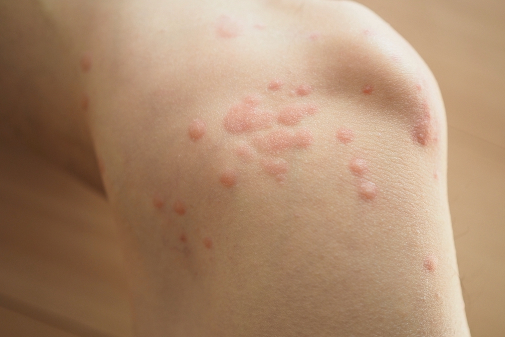 オガサワライラガ自然研小笠原事務所ブログ