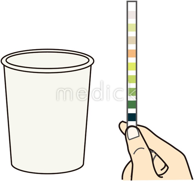 尿と検尿カップのイラスト1イラスト - No: 23790300無料イラスト・フリー素材なら「イラストAC」