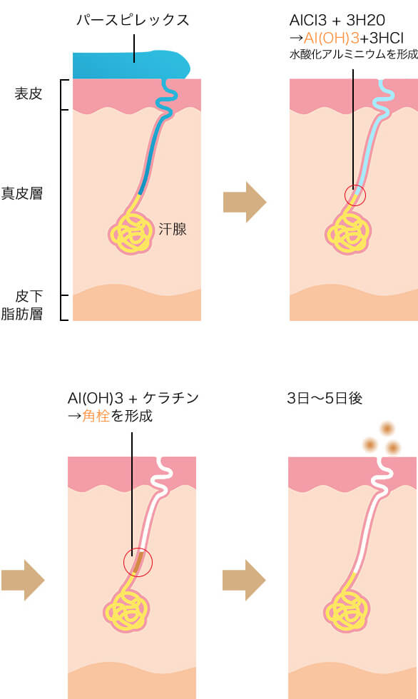 汗止め医療用制汗剤 パースピレックス Perspirexニキビ治療の実績多数セイコメディカル福岡院 美容皮膚科 美容外科